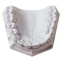 Whipmix - Orthodontic Stone 33lb